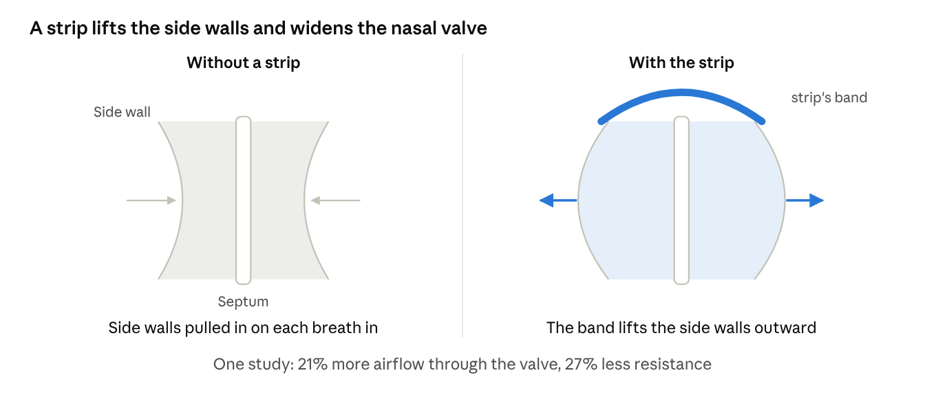 Front view of the nasal valve, without and with a strip.