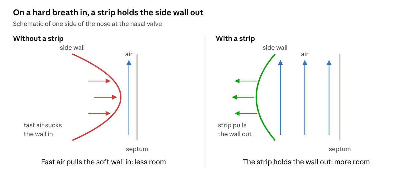 On a hard breath in, fast air pulls the soft side wall in; a strip holds it out.